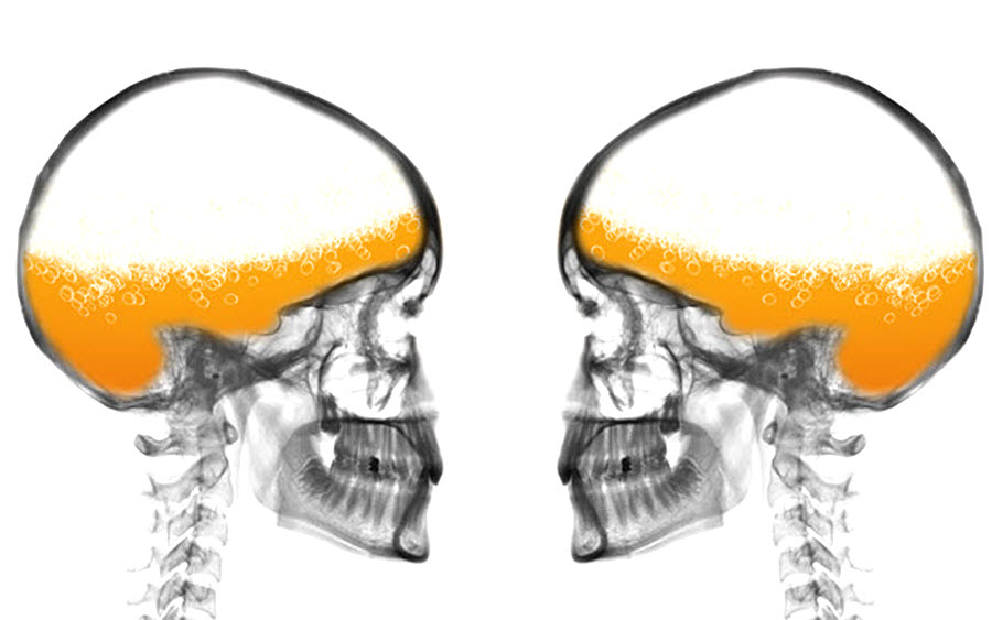  пиво, исследование, допамин, медиатор удовольствия, ПЭТ, позитронно-эмиссионная томография, Gatorade